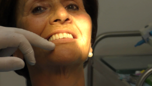 implantologia senza osso impianti dentali zigomatici
